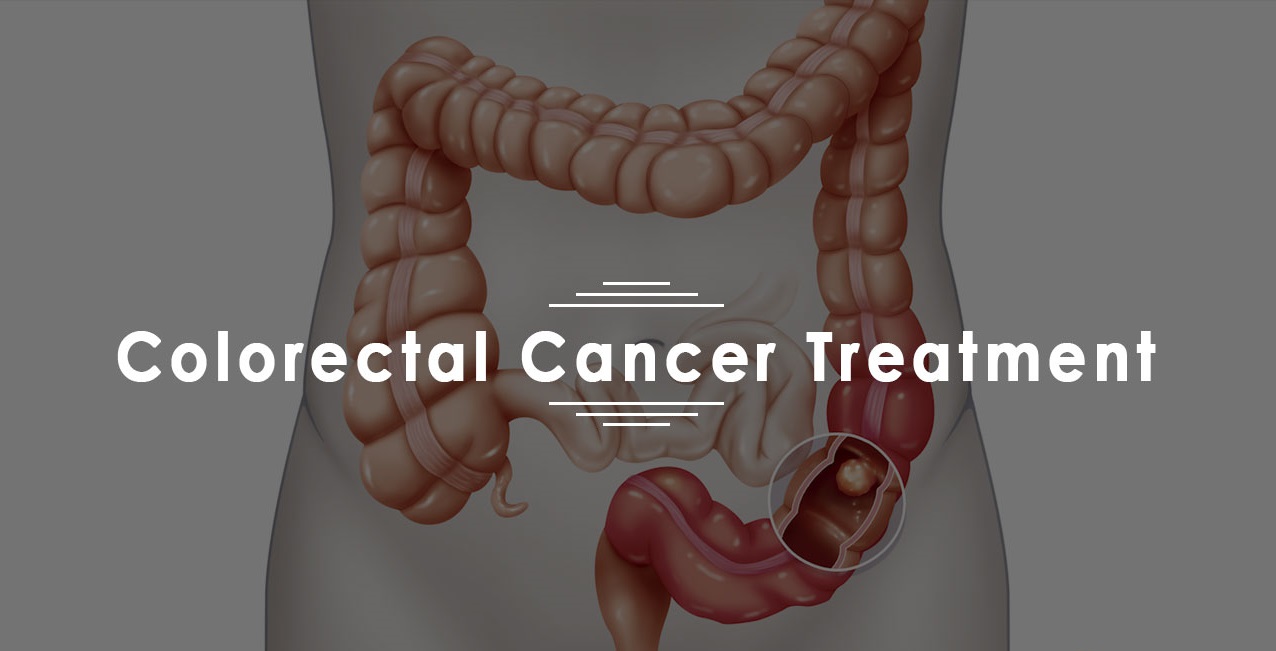 Best Colorectal Cancer Treatment in Ahmedabad India